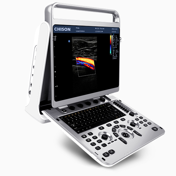 6371df20e2032 Ecograf Doppler pret